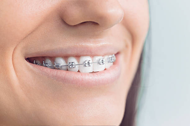 Best Dental Fillings (Composite and Amalgam)  in Lakewood, CO